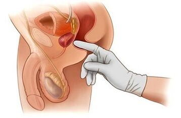 Masage prostata